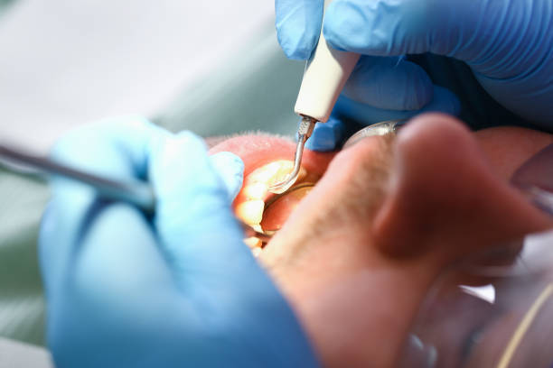 Best Knocked-Out Tooth Emergency  in Brewster Heights, NY